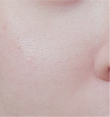 Trước khi sử dụng